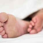 Hallux Valgus