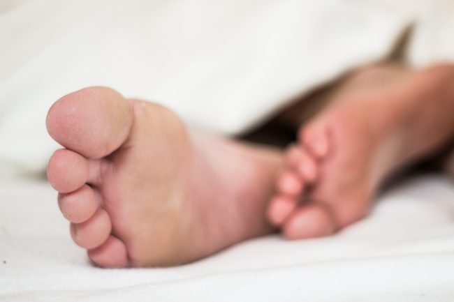 Hallux Valgus