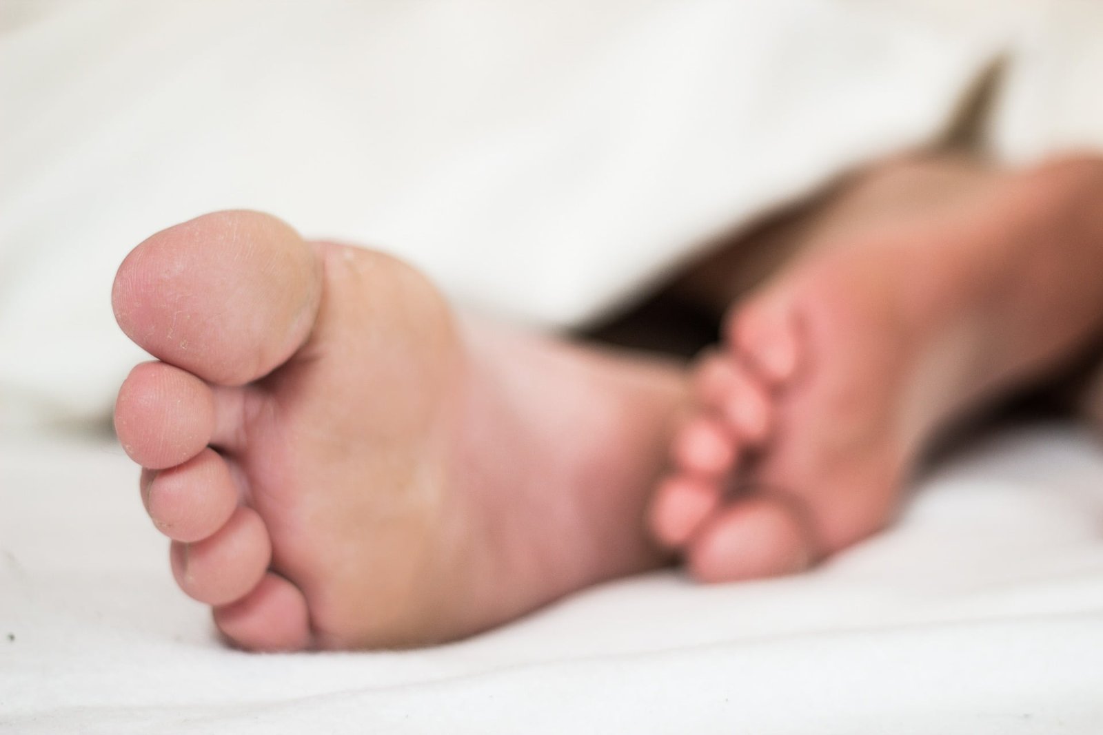 Hallux Valgus