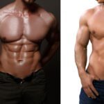 Diástasis en hombres