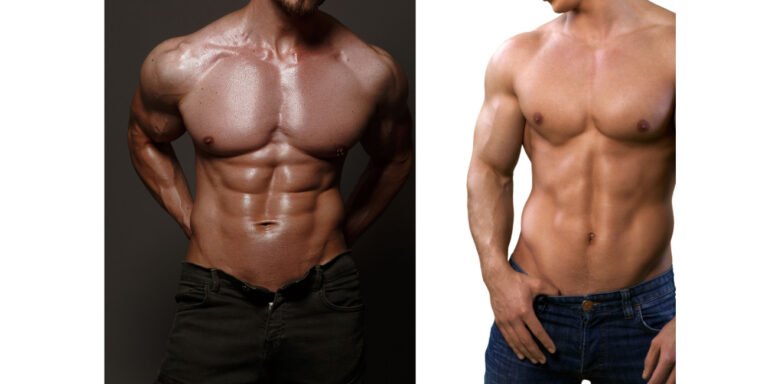 Diástasis en hombres Diástasis en hombres