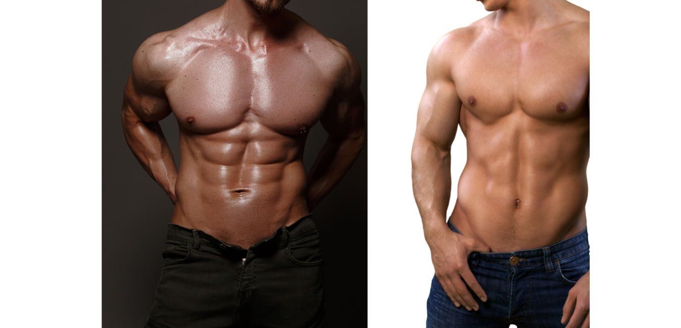 Diástasis en hombres Diástasis en hombres